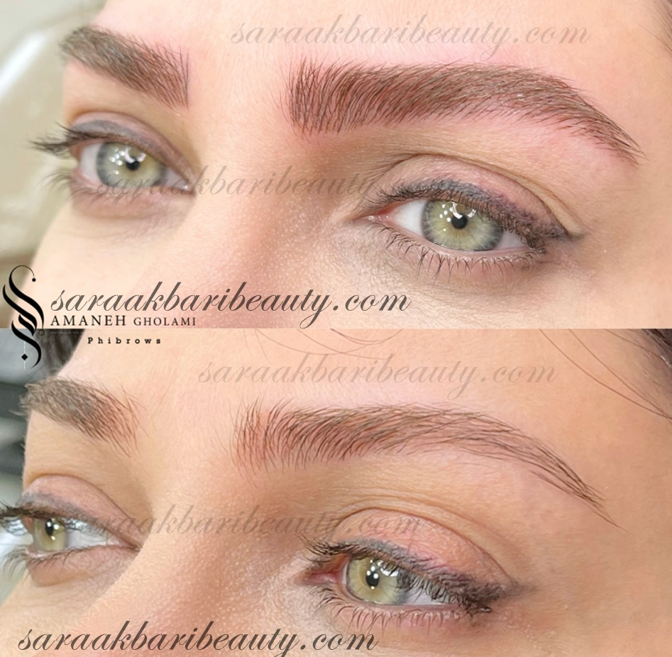 میکروبلیدینگ سارا اکبری